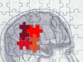 Fundación Instituto San José prepara el I Congreso Nacional de Daño Cerebral en Madrid